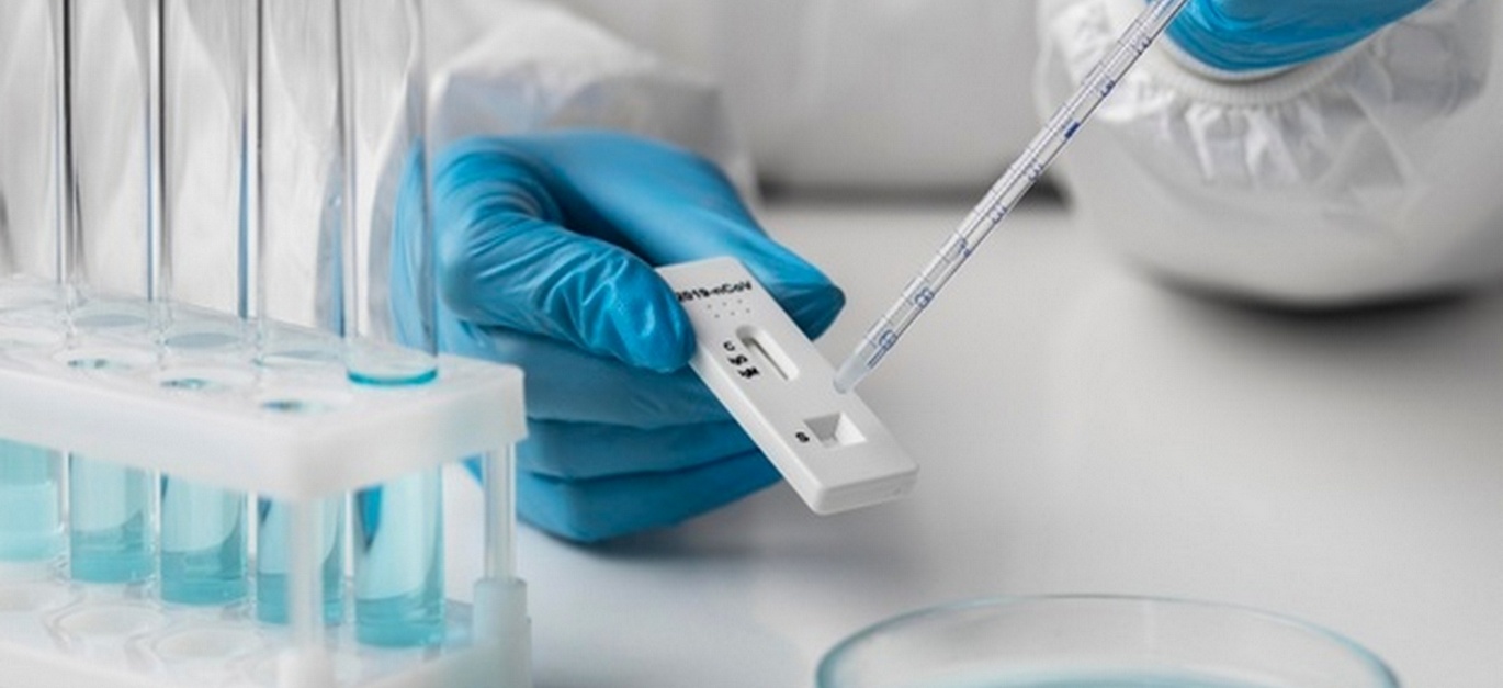 324 на 100 хиляди достигна заболеваемостта от COVID-19 в област Шумен