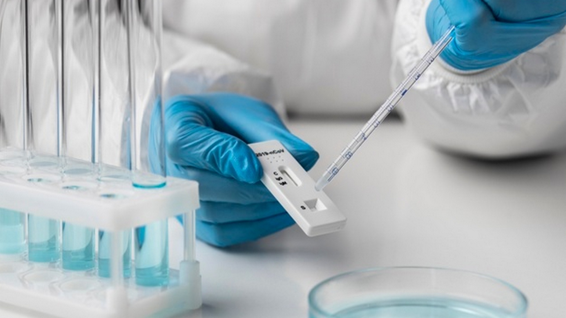 167 души са с ковид в шуменската болница