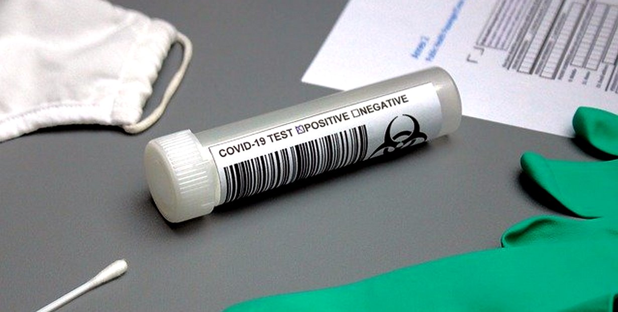 Спад на настанените с ковид в болницата