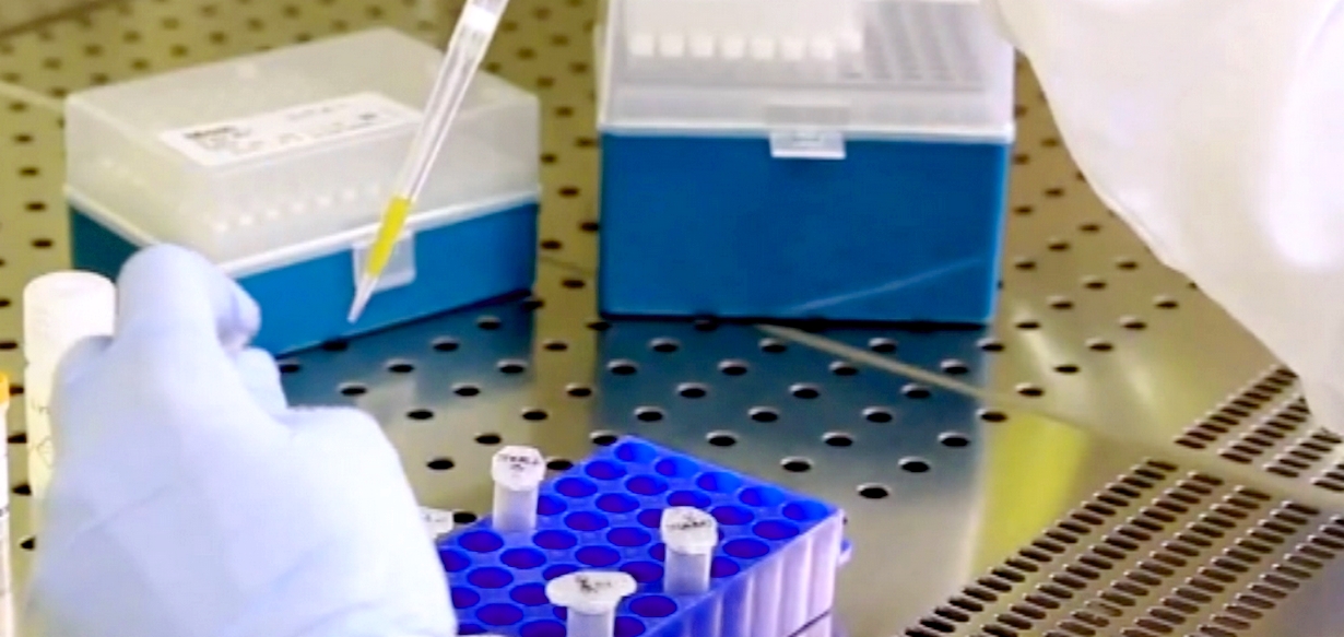 Двама починали с ковид в болницата